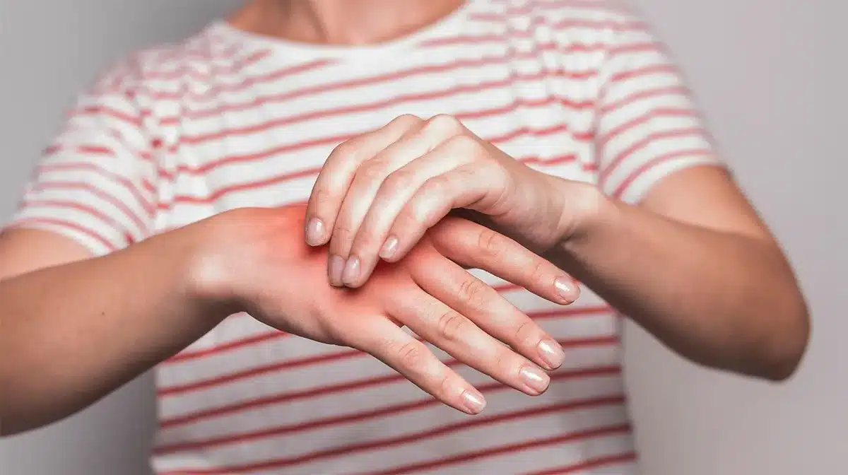 Ragazzo testa le propriet&agrave; antinfiammatorie del CBD